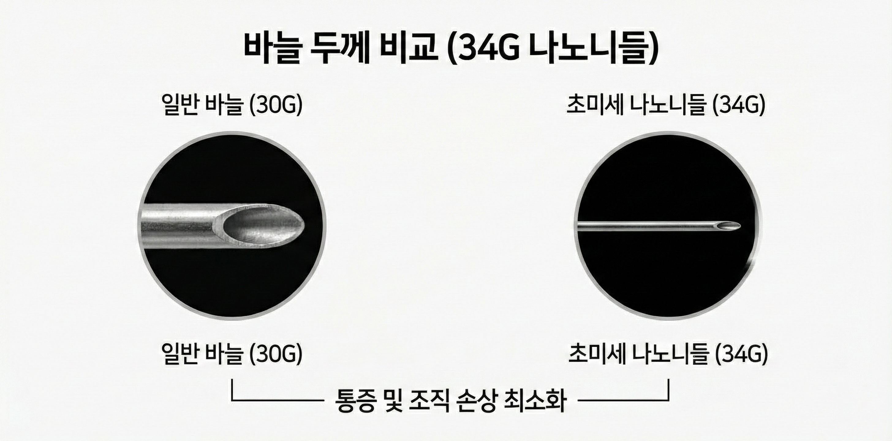 리쥬란 HB+ 큐어젯