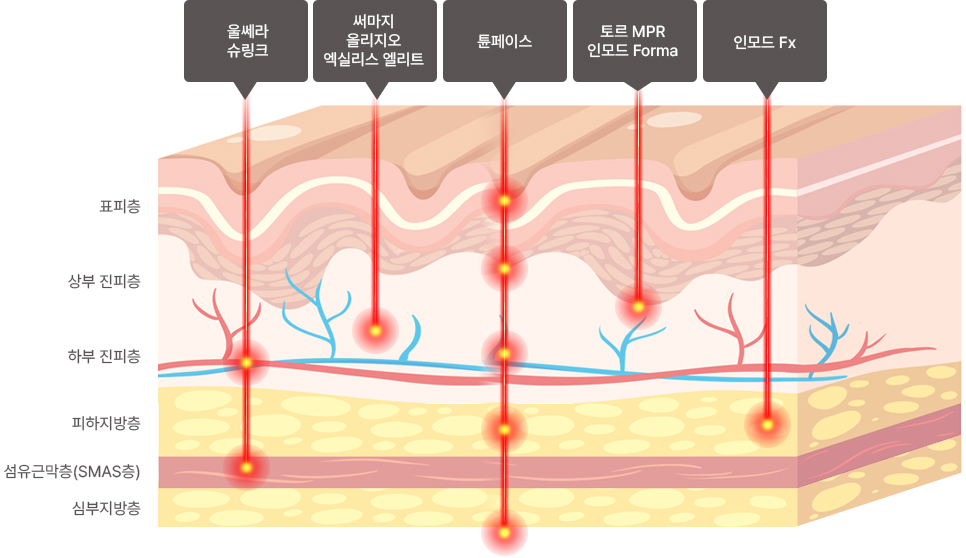 커스텀 리프팅 프로그램 시 복합 치료를 하는 이유
