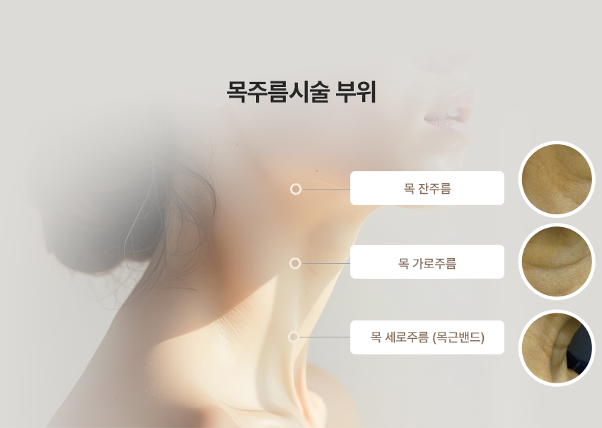 목주름시술 부위