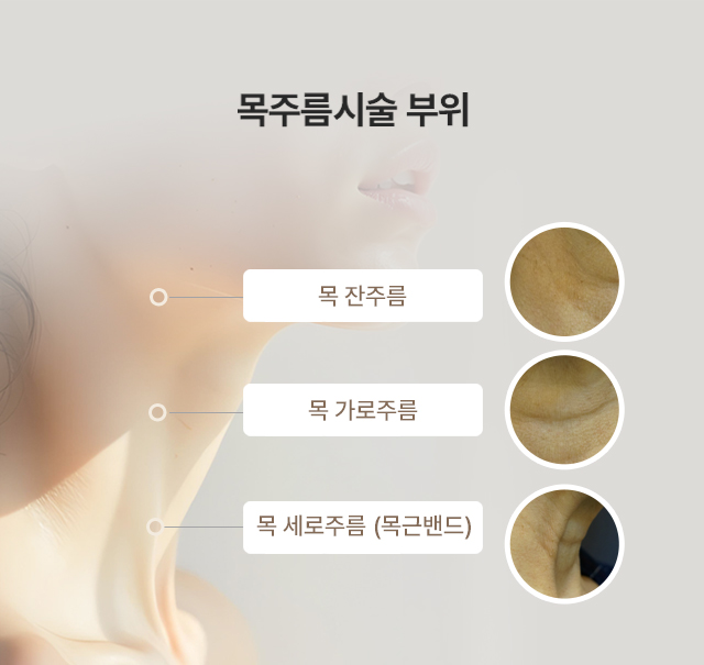 목주름시술 부위