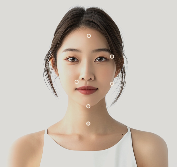 내츄럴 실 리프팅 시술 부위