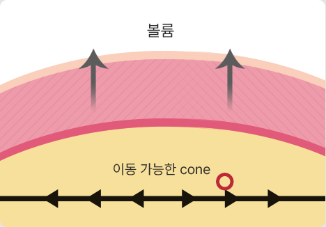 자연스러운 리프팅
