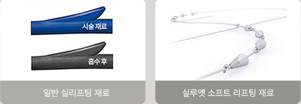 실루엣 소프트 리프팅의 차별점 콜라겐 생성, 무색소 재료