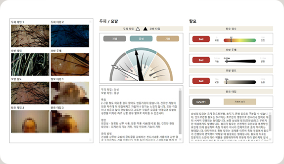탈모 개선 프로그램